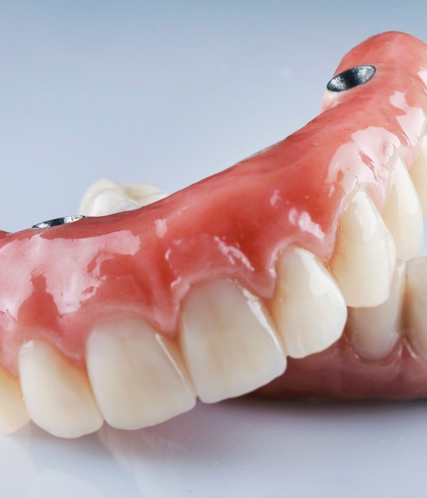 Man considering dental implant retained dentures